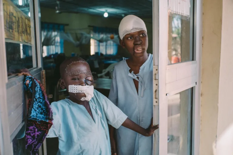 Le noma, maladie méconnue, affecte gravement les enfants au Nigeria nordique