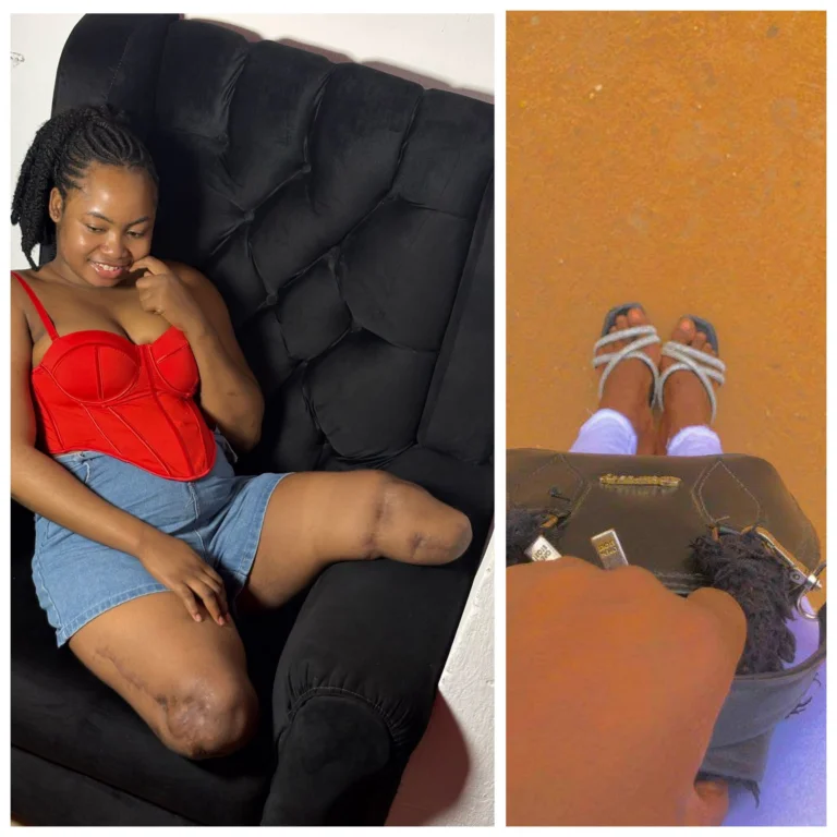 Une Nigériane exprime ses regrets après avoir perdu ses jambes dans un tragique accident